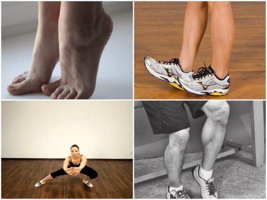 разширените вени причиняват болка в краката