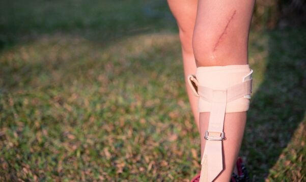 възстановяване на краката след операция за разширени вени