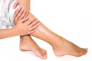 Симптоми на разширени вени на краката при жените